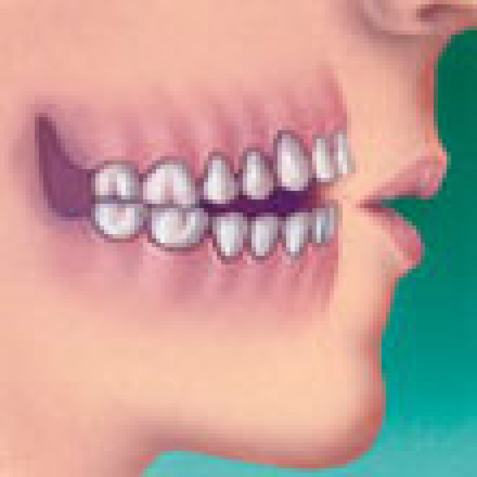 Правильный прикус зубов у человека с протезом